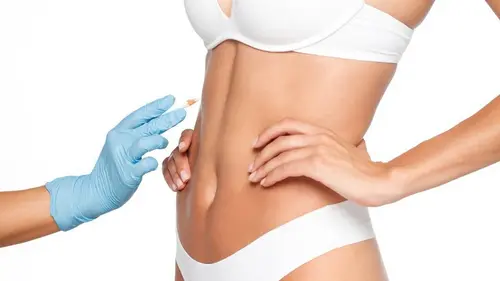 plastične operacije nakon zavjesa